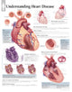 Book cover of: Understanding Heart Disease Laminated Poster. By: Scientific Publishing