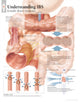 Book cover of: Understanding IBS Laminated Poster. By: Scientific Publishing