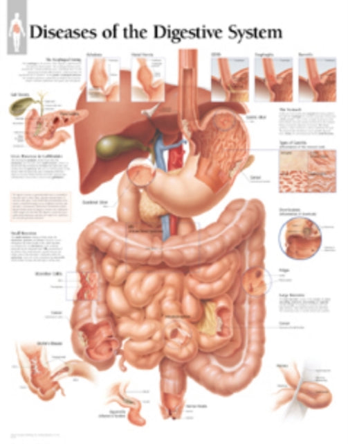 Book cover of: Diseases of the Digestive System Paper Poster. By: Scientific Publishing