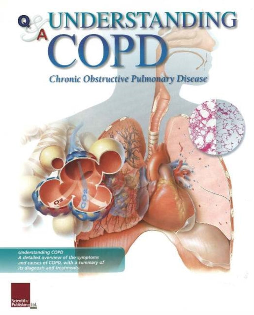 Book cover of: Understanding COPD Flip Chart. By: Scientific Publishing Ltd.