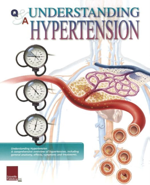 Book cover of: Understanding Hypertension Flip Chart. By: Scientific Publishing Ltd.