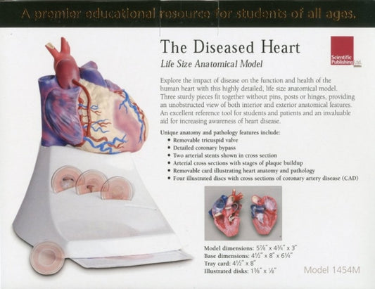 Book cover of: Life Size Diseased Heart Model