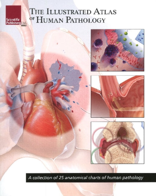 Book cover of: Illustrated Atlas of Human Pathology