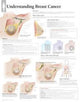 Book cover of: Understanding Breast Cancer Paper Poster