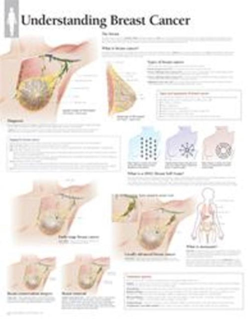 Book cover of: Understanding Breast Cancer Laminated Poster
