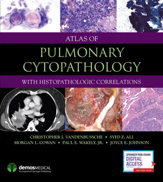 Book cover of: Atlas of Pulmonary Cytopathology. By: Christopher J. VandenBussche MD  PhD