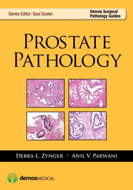 Book cover of: Prostate Pathology. By: Debra L. Zynger