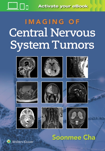 Book cover of: Imaging of Central Nervous System Tumors. By: Cha