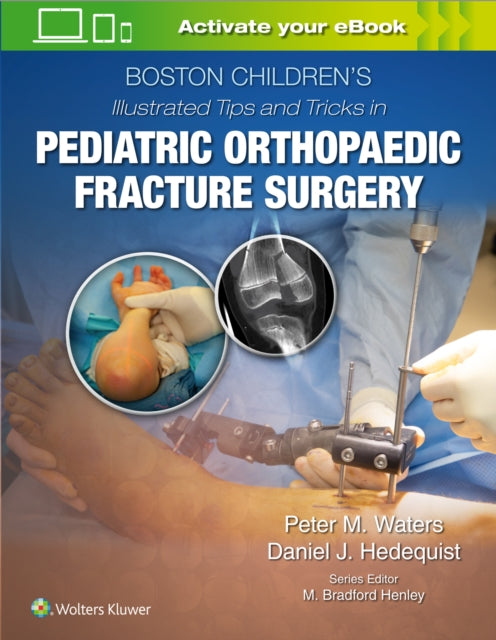 Book cover of: Boston Children’s Illustrated Tips and Tricks  in Pediatric Orthopaedic Fracture Surgery. By: Peter M Waters MD