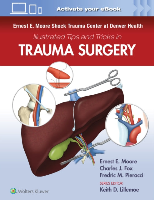Book cover of: Ernest E. Moore Shock Trauma Center at Denver Health Illustrated Tips and Tricks in Trauma Surgery. By: Ernest E. Moore