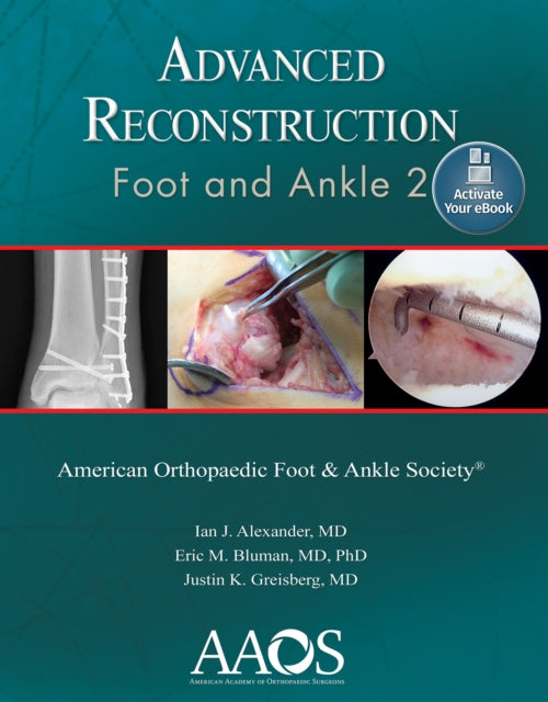 Book cover of: Advanced Reconstruction: Foot and Ankle 2: Print + Ebook. By: Ian J. Alexander M.D.