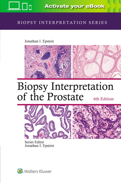 Book cover of: Biopsy Interpretation of the Prostate. By: Jonathan I. Epstein