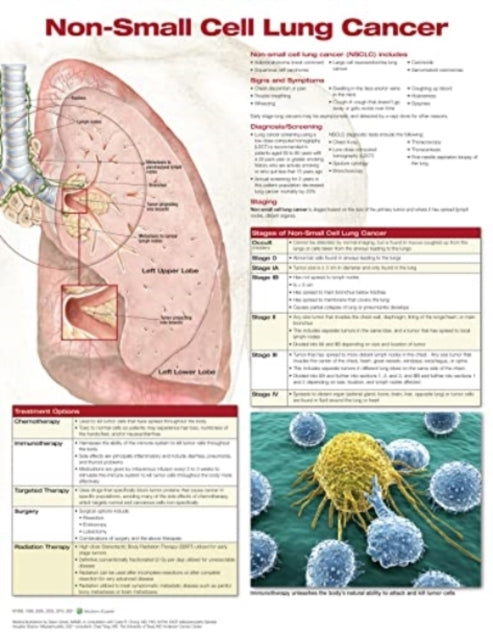 Book cover of: Non-Small Cell Lung Cancer, Chart Laminated