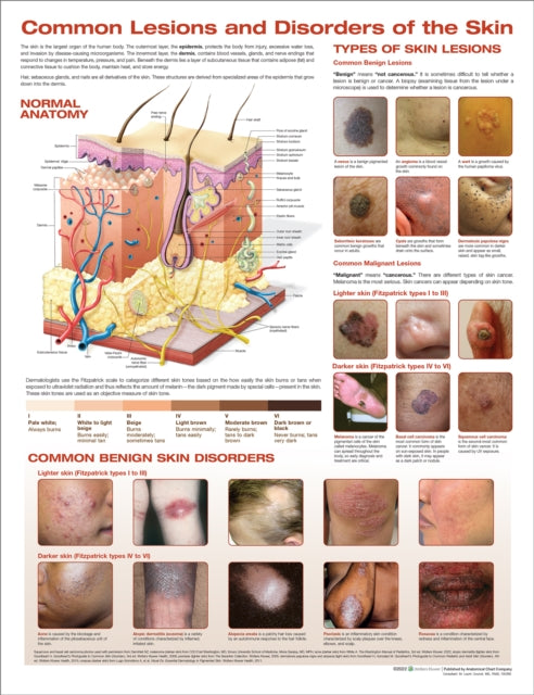 Book cover of: Common Lesions and Disorders of the Skin Anatomical Chart