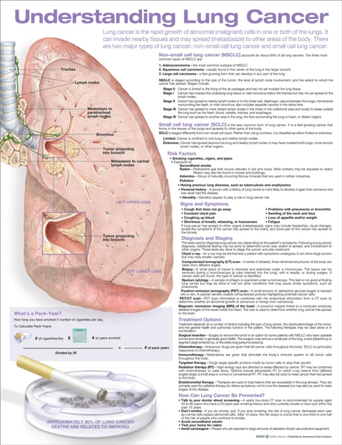 Book cover of: Understanding Lung Cancer Anatomical Chart
