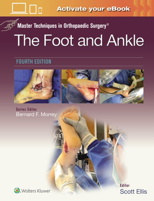 Book cover of: Master Techniques in Orthopaedic Surgery: The Foot and Ankle: Print + eBook with Multimedia. By: Scott Ellis
