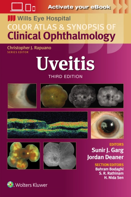 Book cover of: Uveitis. By: Sunir J. Garg