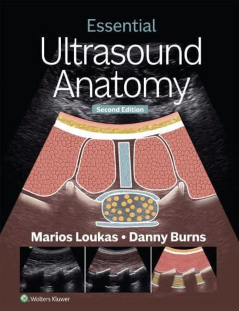 Book cover of: Essential Ultrasound Anatomy. By: Marios Loukas