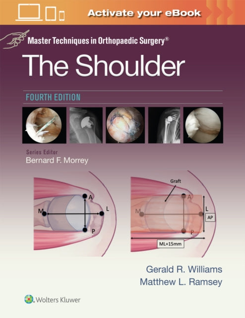 Book cover of: Master Techniques in Orthopaedic Surgery: The Shoulder: Print + eBook with Multimedia. By: WILLIAMS, Gerald R., Jr.