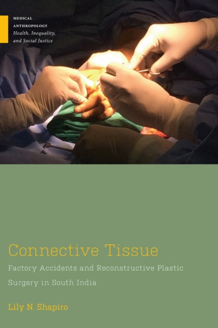 Book cover of: Connective Tissue. By: Lily N. Shapiro