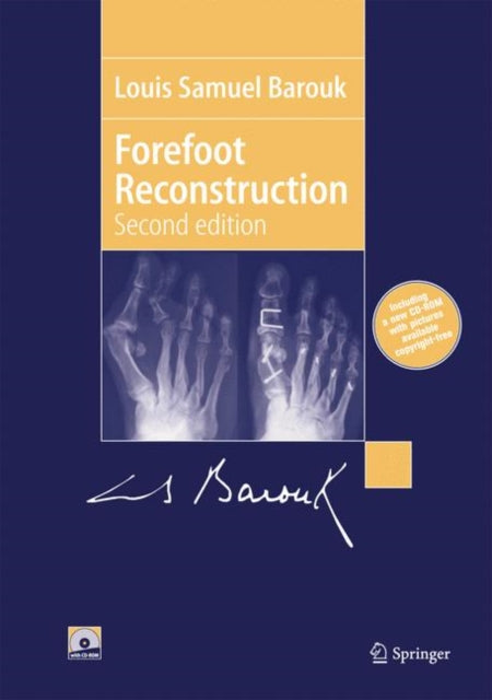 Book cover of: Forefoot Reconstruction. By: Louis-Samuel Barouk