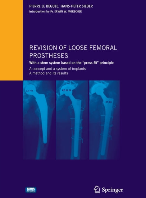 Book cover of: Revision of loose femoral prostheses with a stem system based on the "press-fit" principle. By: Pierre Le Béguec