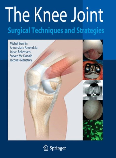 Book cover of: Knee Joint. By: Michel Bonnin