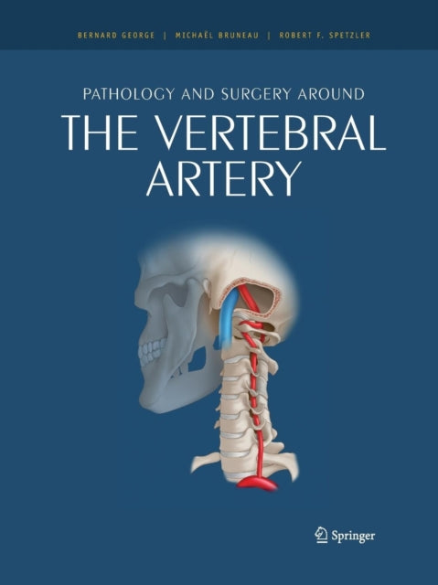 Book cover of: Pathology and surgery around the vertebral artery. By: Bernard George