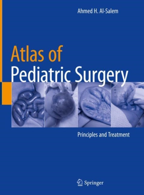 Book cover of: Atlas of Pediatric Surgery. By: Ahmed H. Al-Salem