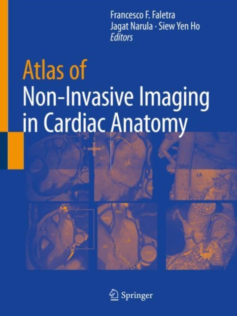 Book cover of: Atlas of Non-Invasive Imaging in Cardiac Anatomy. By: Francesco F. Faletra
