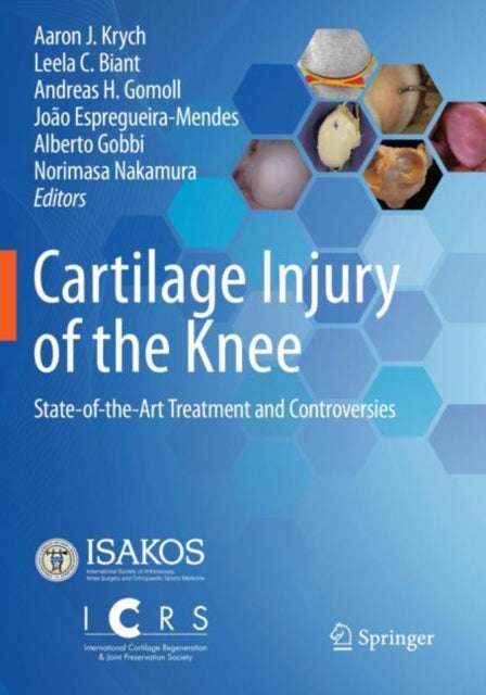 Book cover of: Cartilage Injury of the Knee. By: Aaron J. Krych