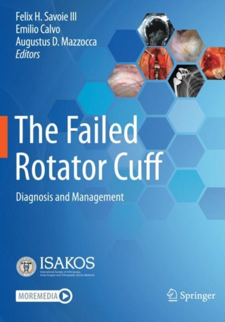 Book cover of: Failed Rotator Cuff. By: Felix H. Savoie III