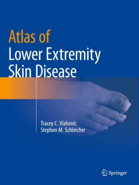Book cover of: Atlas of Lower Extremity Skin Disease. By: Tracey C. Vlahovic
