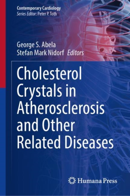 Book cover of: Cholesterol Crystals in Atherosclerosis and Other Related Diseases. By: George S. Abela
