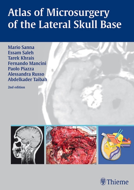 Book cover of: Atlas of Microsurgery of the Lateral Skull Base. By: Mario Sanna