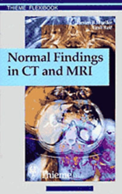 Book cover of: Normal Findings in CT and MRI, A1, Print. By: Therald Moeller