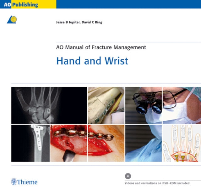 Book cover of: AO Manual of Fracture Management - Hand and Wrist. By: Jesse B. Jupiter