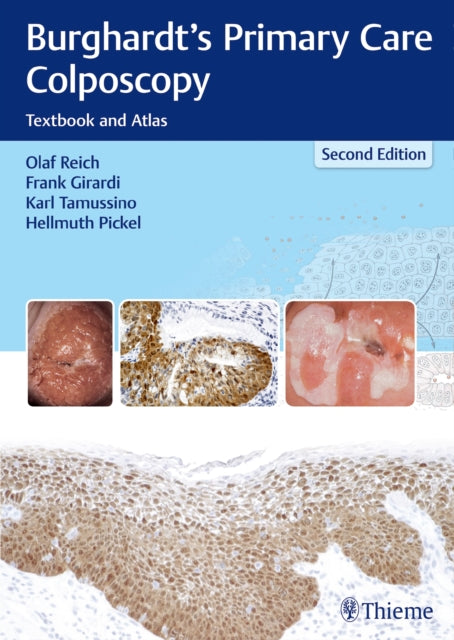 Book cover of: Burghardt's Primary Care Colposcopy. By: Olaf Reich
