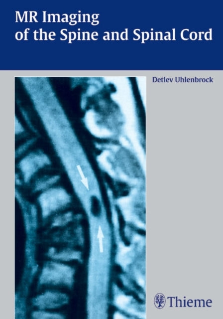 Book cover of: MR Imaging of the Spine and Spinal Cord. By: Detlev Uhlenbrock
