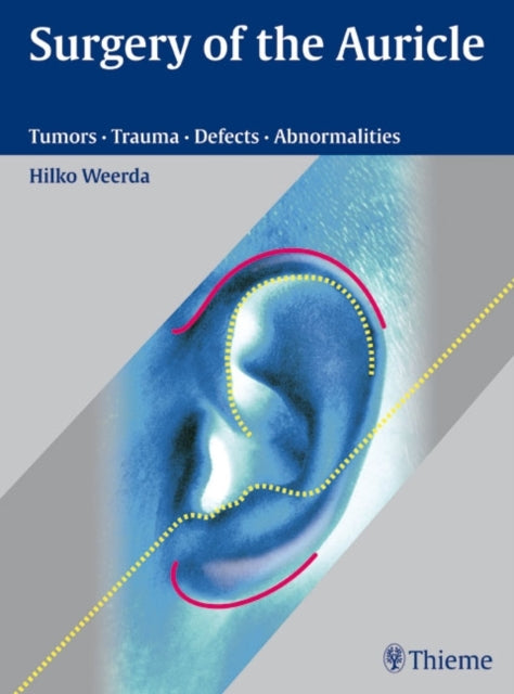 Book cover of: Surgery of the Auricle