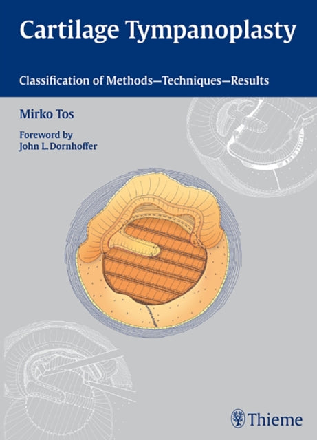 Book cover of: Cartilage Tympanoplasty. By: Mirko Tos