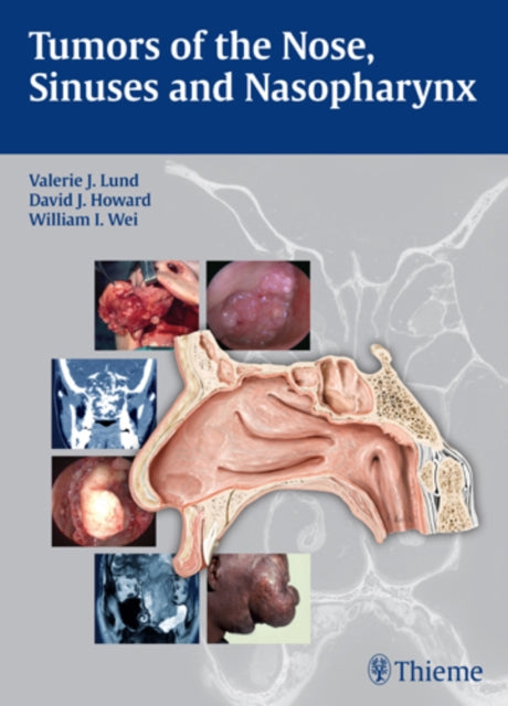 Book cover of: Tumors of the Nose, Sinuses and Nasopharynx. By: Valerie J. Lund