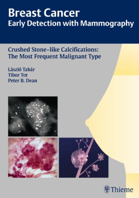 Book cover of: Breast Cancer: Early Detection with Mammography. By: László Tabár