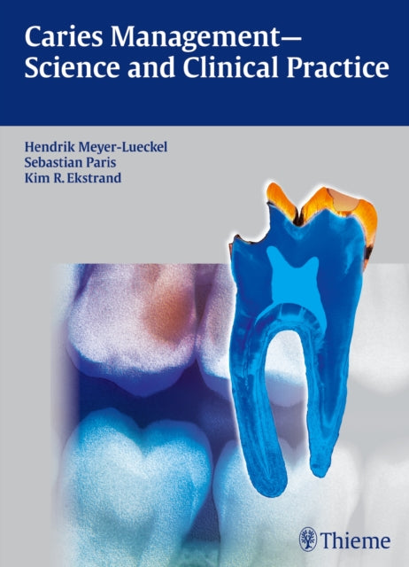 Book cover of: Caries Management - Science and Clinical Practice