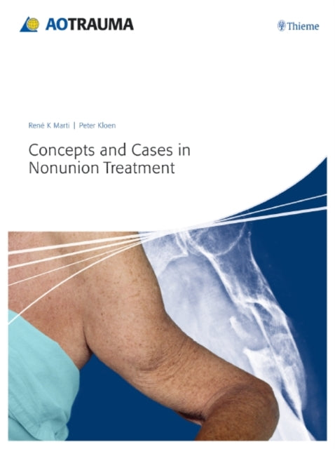 Book cover of: Concepts and Cases in Nonunion Treatment