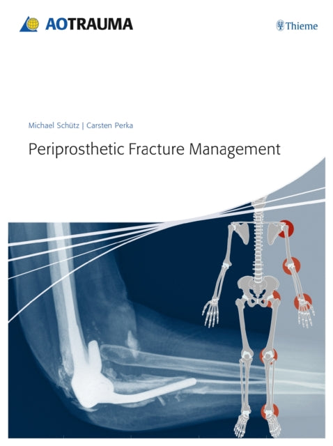 Book cover of: Periprosthetic Fracture Management. By: Schütz, Michael (Professor of traumatology)