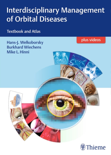 Book cover of: Interdisciplinary Management of Orbital Diseases. By: Hans-Jürgen Welkoborsky