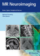 Book cover of: MR Neuroimaging. By: Michael Forsting