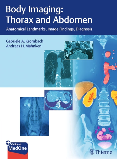 Book cover of: Body Imaging: Thorax and Abdomen. By: Gabriele A. Krombach