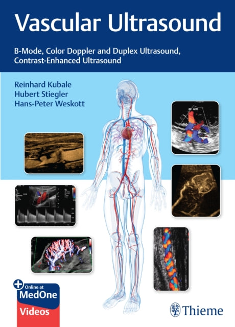 Book cover of: Vascular Ultrasound. By: Reinhard Kubale
